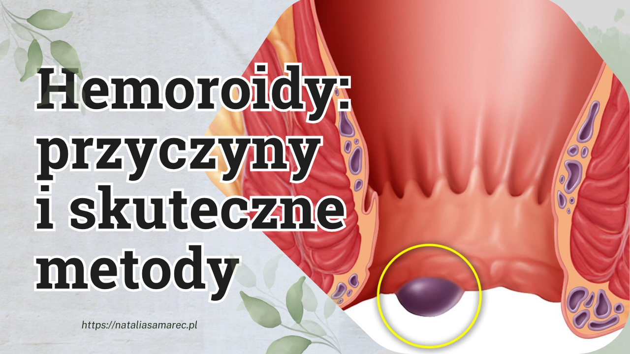 Hemoroidy